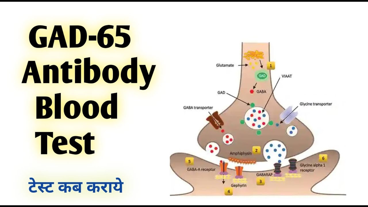 GAD-65 Antibody Test: What You Need to Know