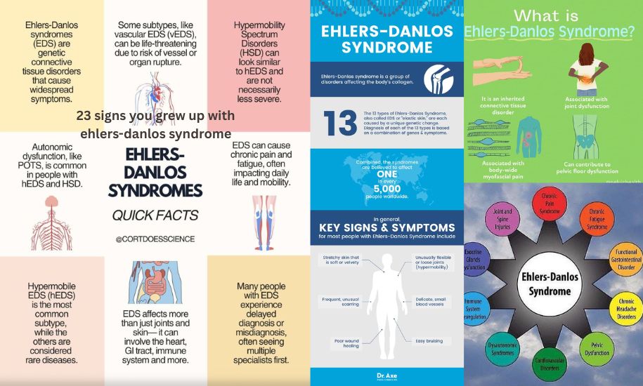 23 signs you grew up with ehlers-danlos syndrome